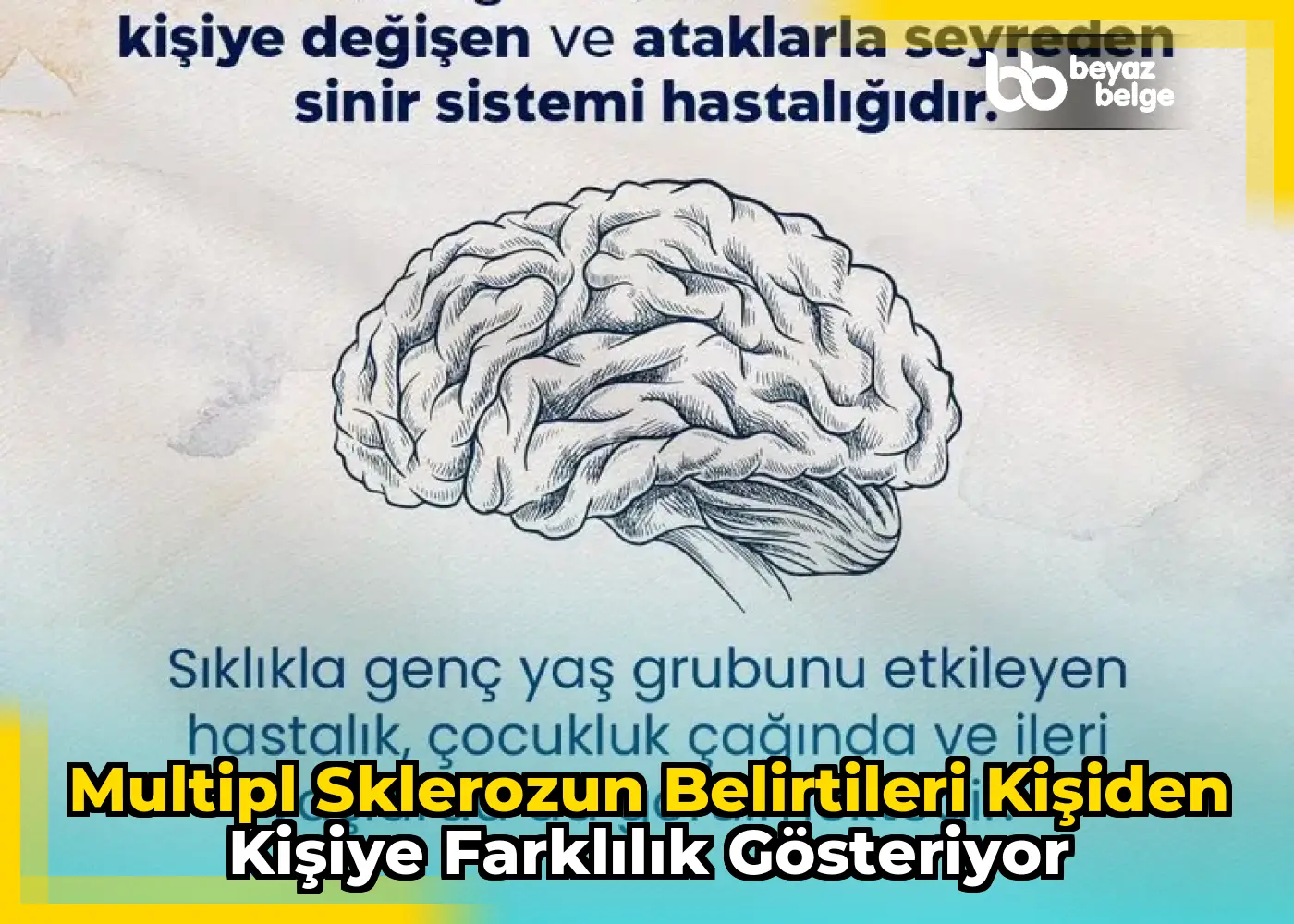 Multipl sklerozun belirtileri kişiden kişiye farklılık gösteriyor
