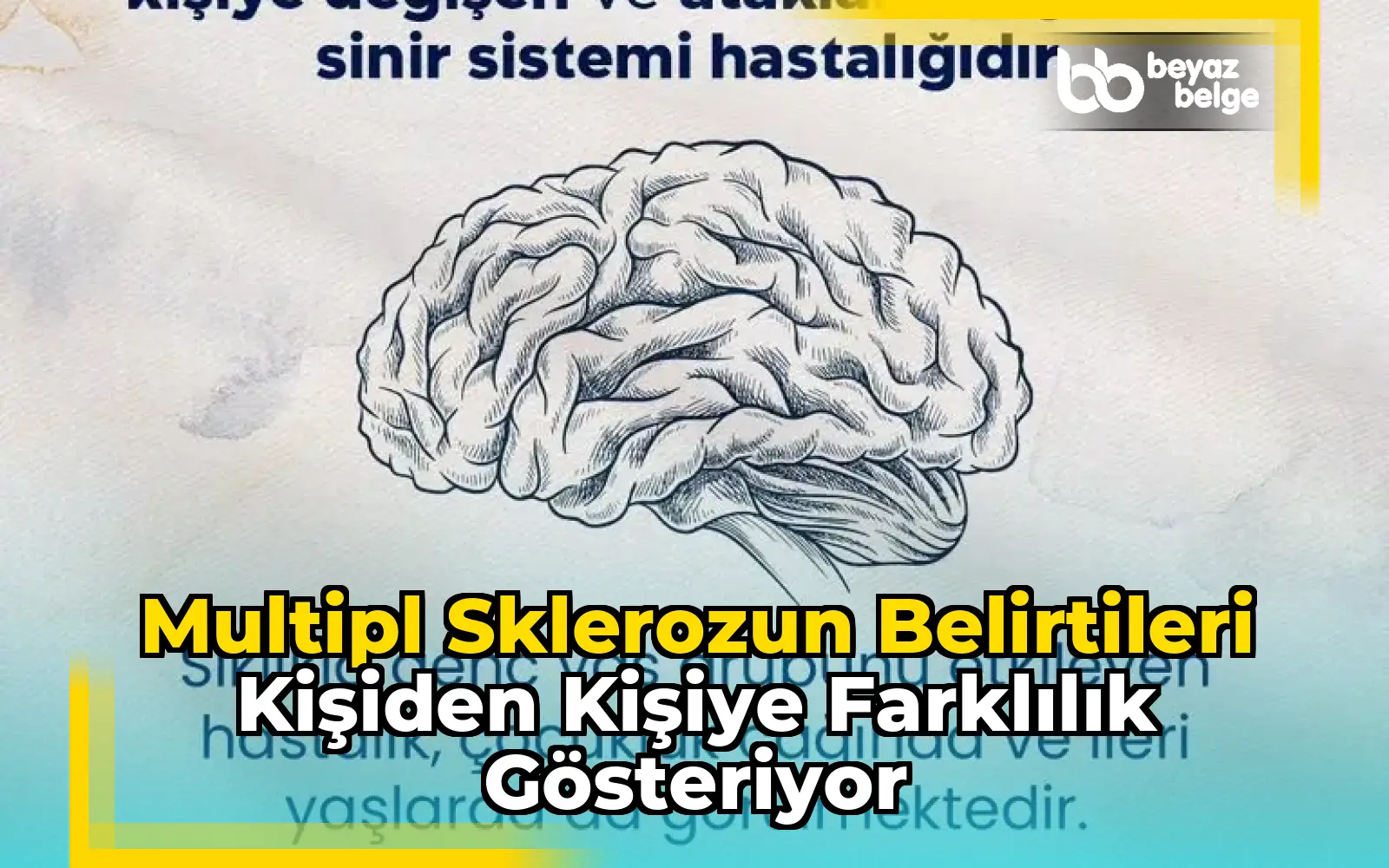 Multipl sklerozun belirtileri kişiden kişiye farklılık gösteriyor